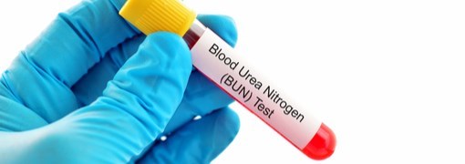 בדיקת רמת BUN בדם (Blood Urea Nitrogen)   - תמונה